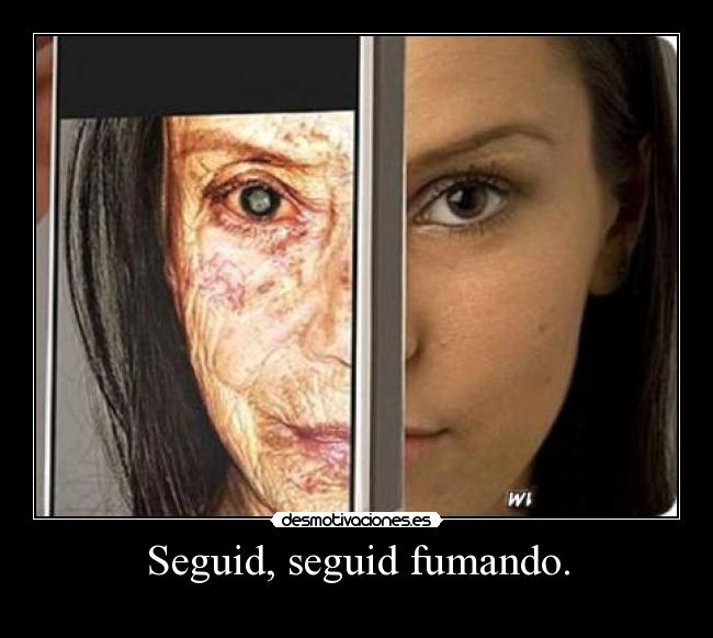 Seguid, seguid fumando. - 