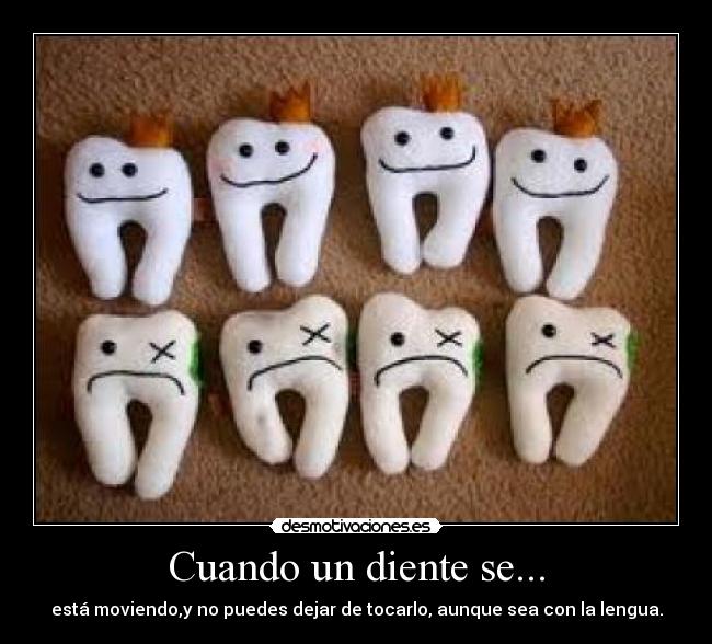 Cuando un diente se... - 