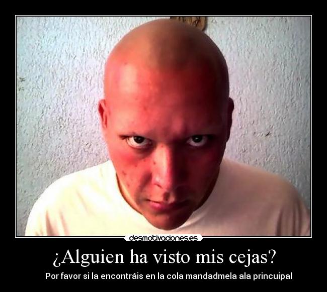 ¿Alguien ha visto mis cejas? -