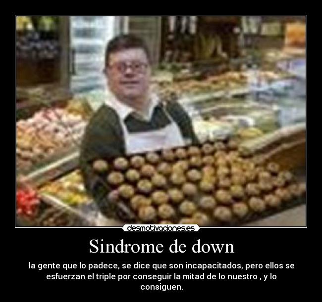 Sindrome de down -