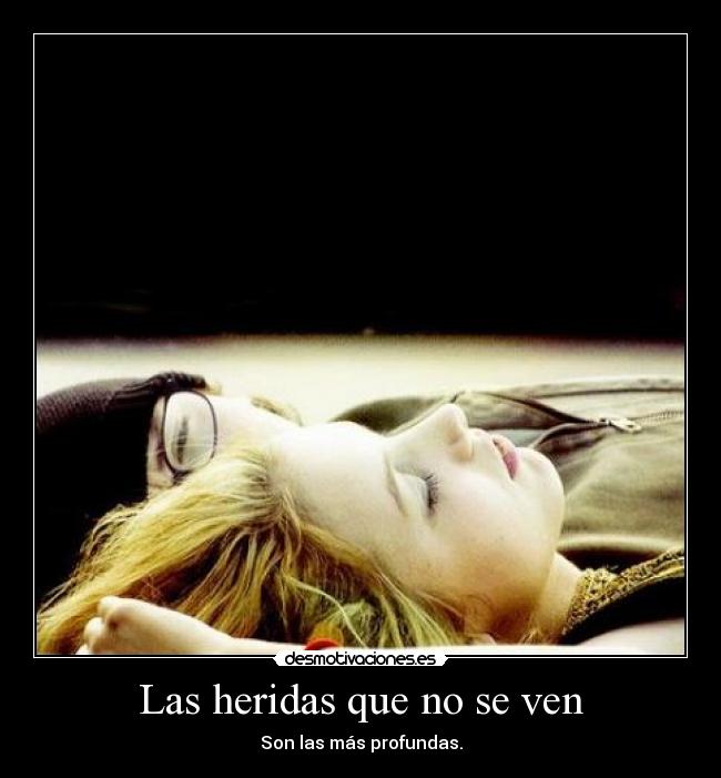 Las heridas que no se ven - Son las más profundas.