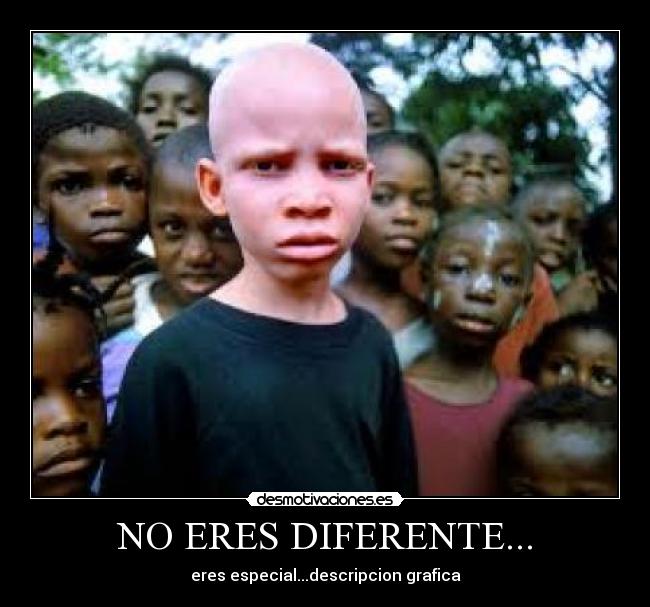 NO ERES DIFERENTE... - 