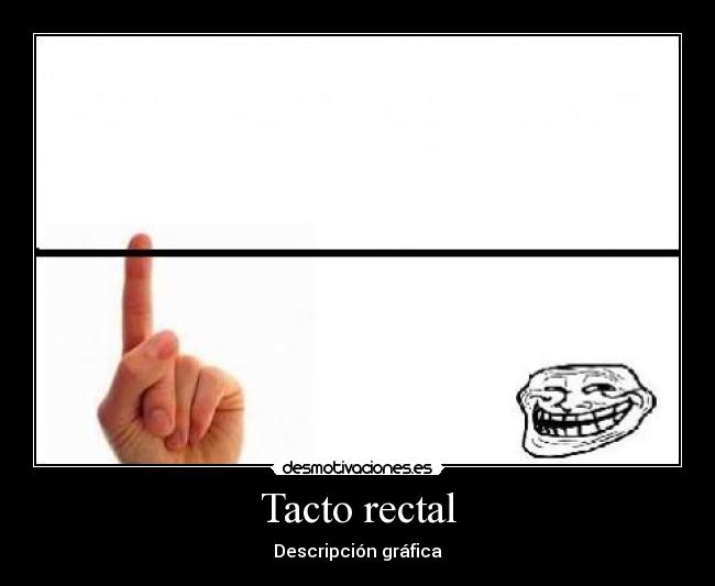 Tacto rectal - Descripción gráfica