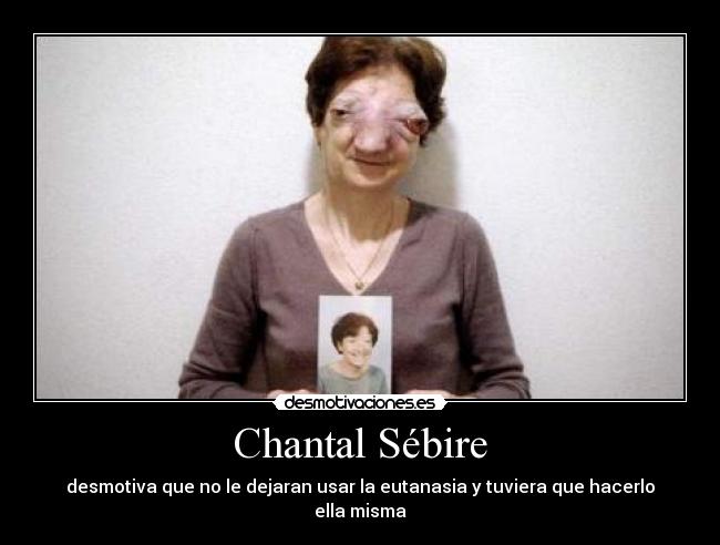 Chantal Sébire - desmotiva que no le dejaran usar la eutanasia y tuviera que hacerlo ella misma