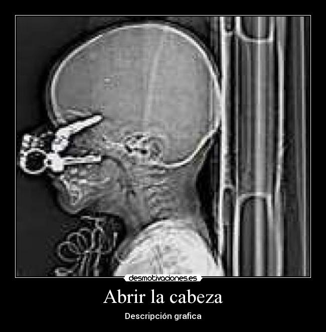Abrir la cabeza - 