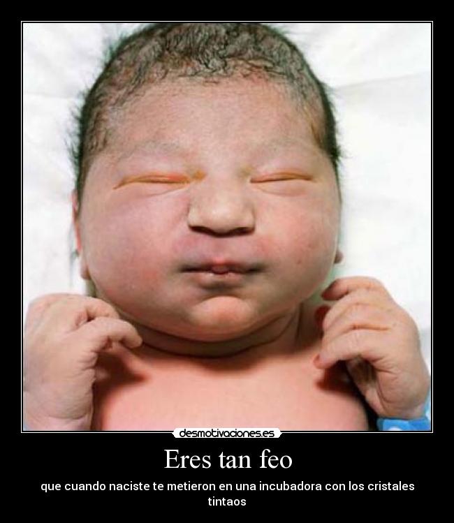 Eres tan feo - que cuando naciste te metieron en una incubadora con los cristales tintaos