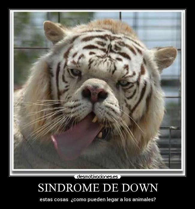 SINDROME DE DOWN - 