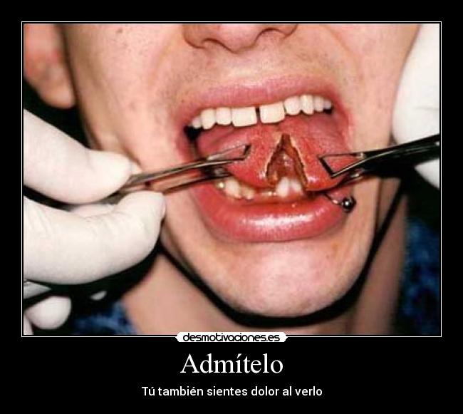 Admítelo - Tú también sientes dolor al verlo