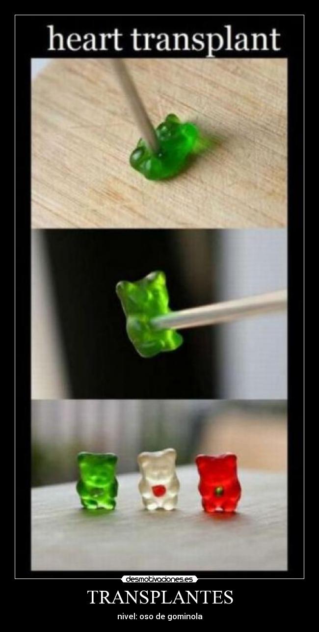 TRANSPLANTES - 