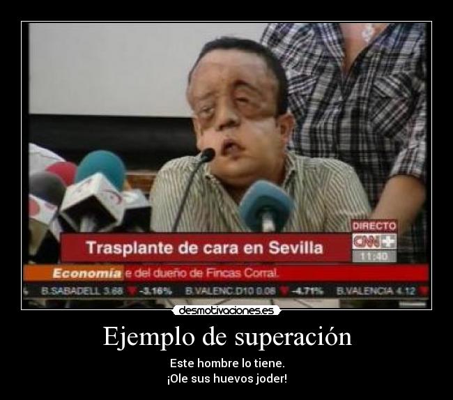 Ejemplo de superación - Este hombre lo tiene.
¡Ole sus huevos joder!
