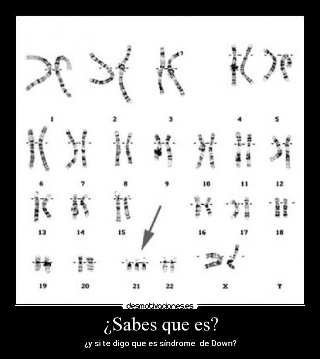 ¿Sabes que es? - ¿y si te digo que es síndrome de Down?