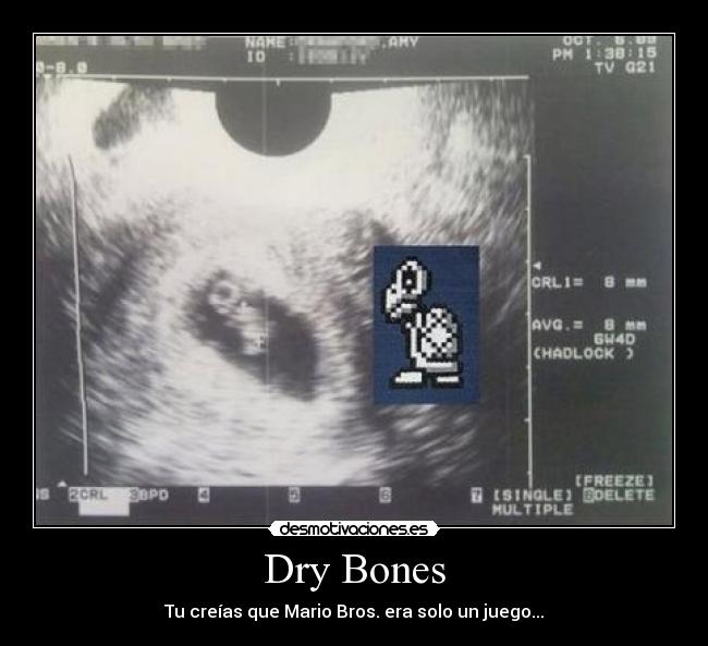 Dry Bones - 