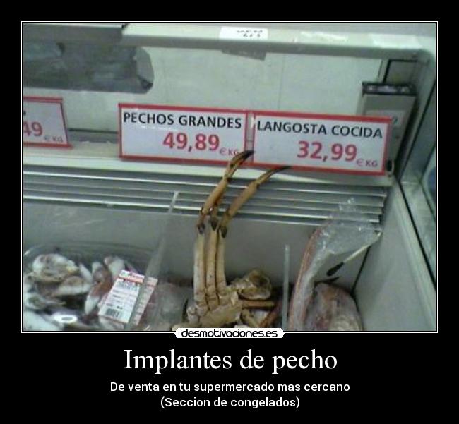 Implantes de pecho - 