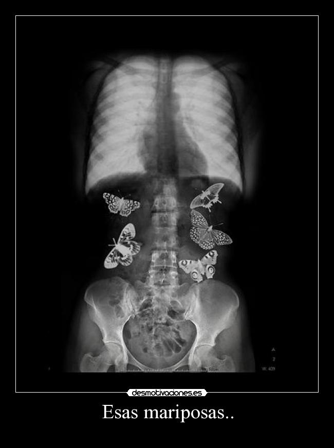 Esas mariposas.. -