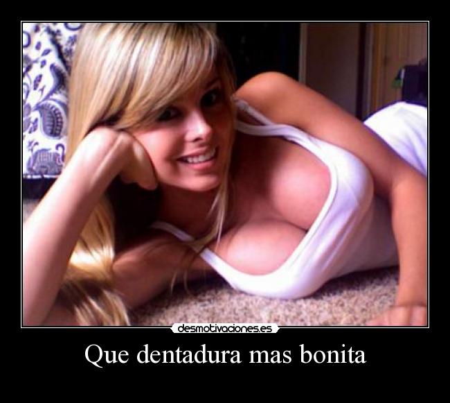 Que dentadura mas bonita - 