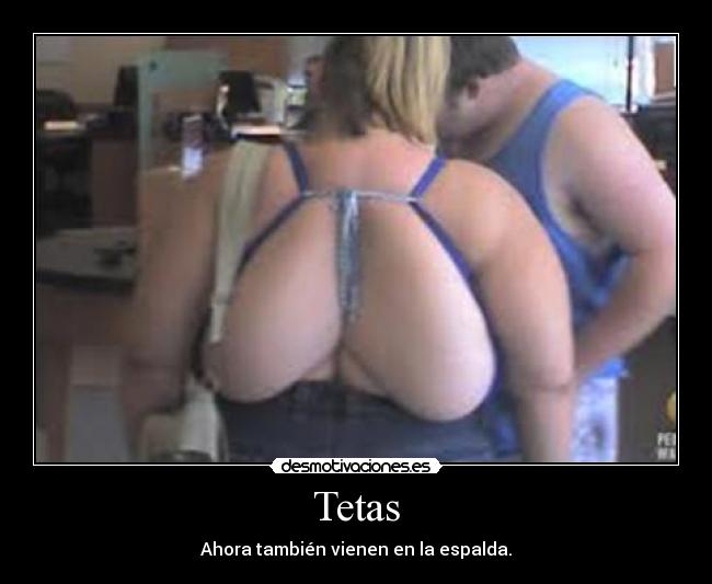 Tetas - Ahora también vienen en la espalda.
