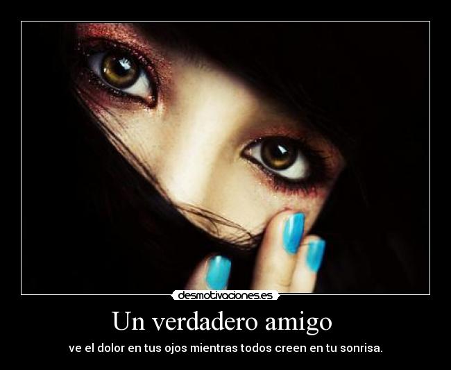 Un verdadero amigo  - 