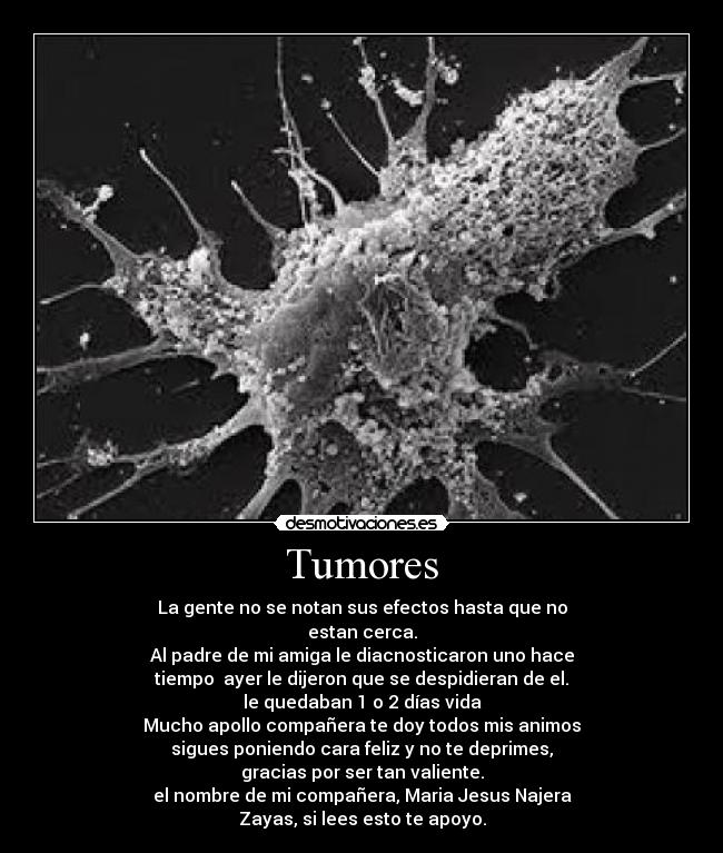 Tumores - La gente no se notan sus efectos hasta que no
estan cerca.
Al padre de mi amiga le diacnosticaron uno hace
tiempo  ayer le dijeron que se despidieran de el.
le quedaban 1 o 2 días vida
Mucho apollo compañera te doy todos mis animos
sigues poniendo cara feliz y no te deprimes,
gracias por ser tan valiente.
el nombre de mi compañera, Maria Jesus Najera
Zayas, si lees esto te apoyo.