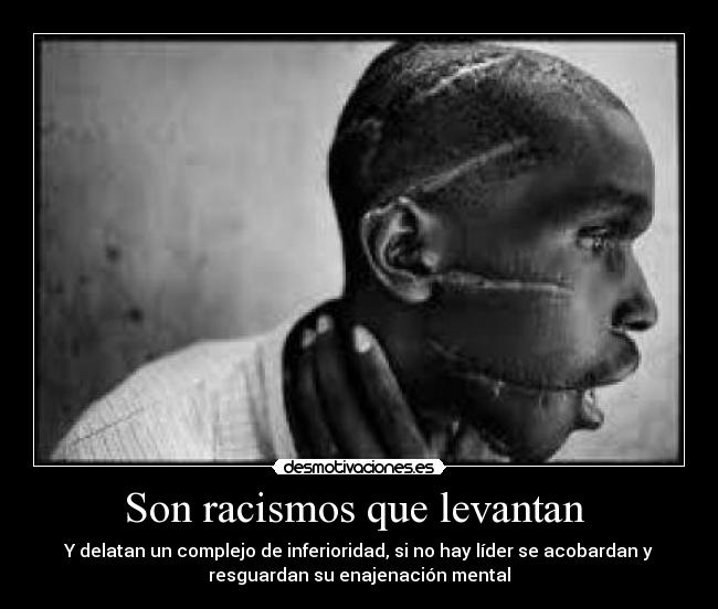 Son racismos que levantan  - 