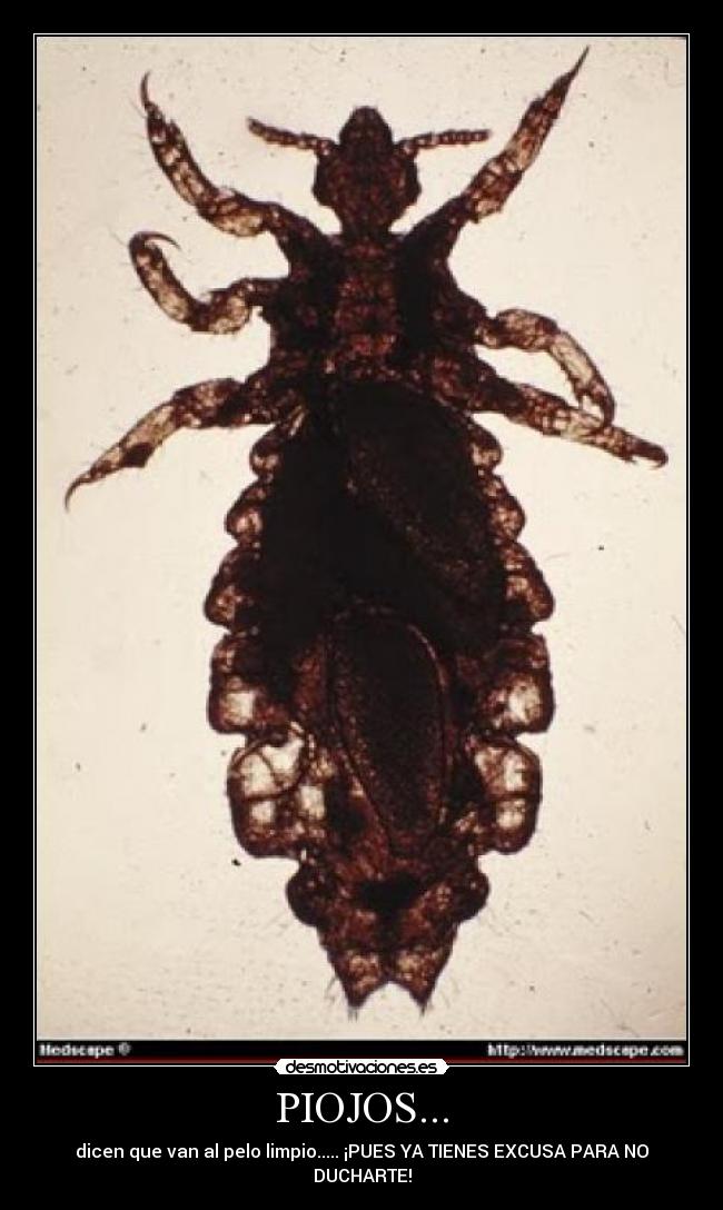 PIOJOS... - dicen que van al pelo limpio..... ¡PUES YA TIENES EXCUSA PARA NO DUCHARTE!