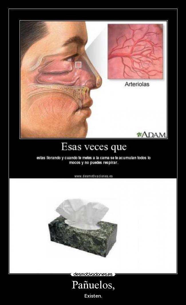 Pañuelos, - Existen.