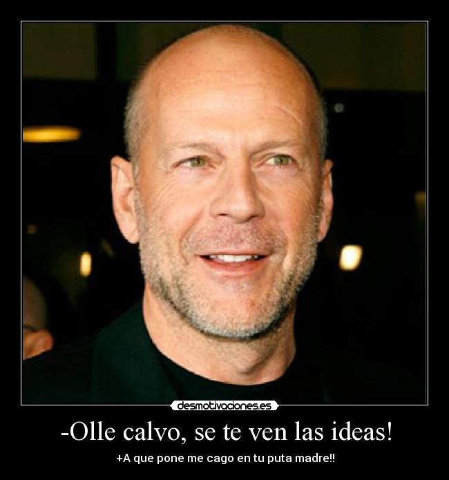 -Olle calvo, se te ven las ideas! - 
