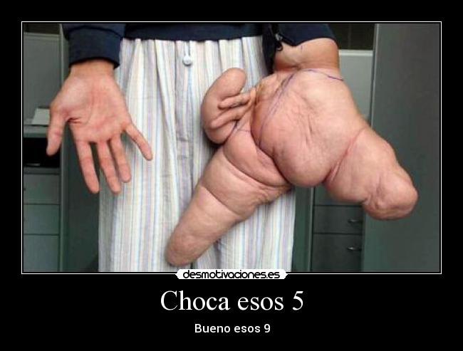 Choca esos 5 - 