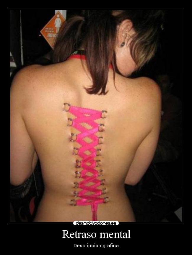 Retraso mental - Descripción gráfica