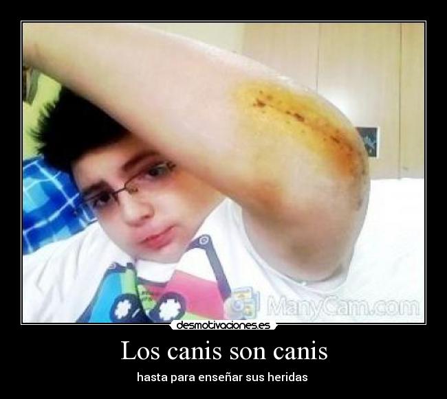 Los canis son canis - hasta para enseñar sus heridas
