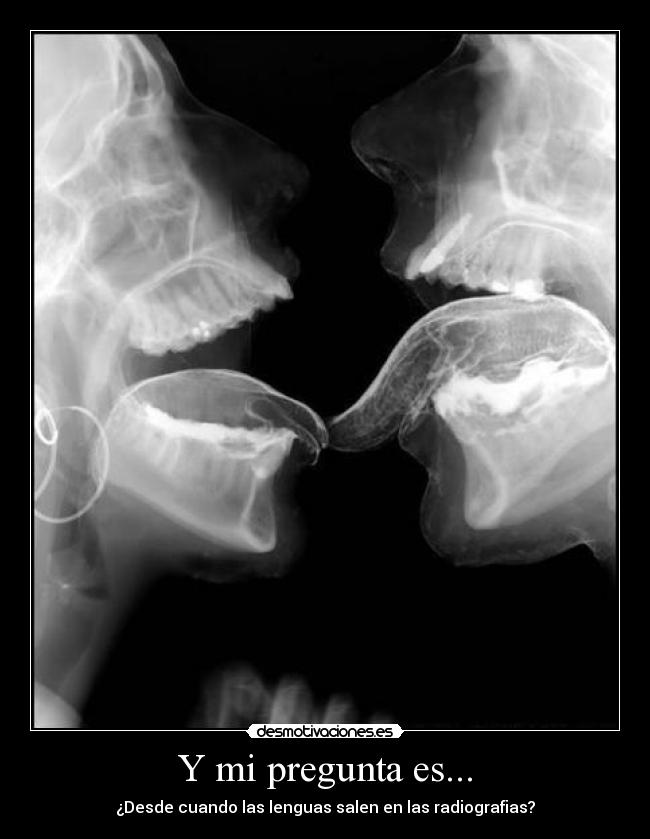 Y mi pregunta es... -