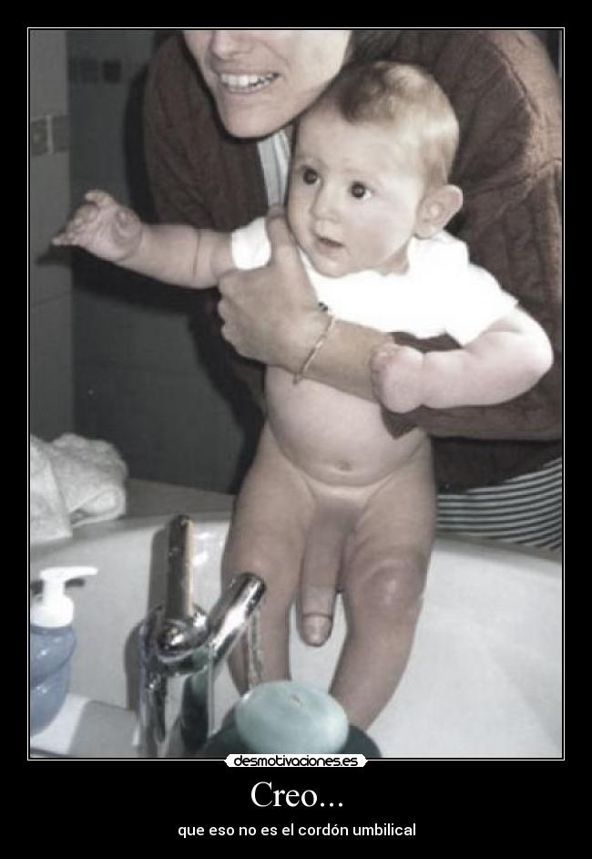 Creo... - que eso no es el cordón umbilical