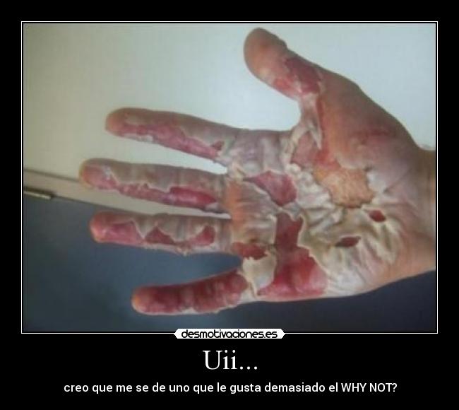 Uii... - creo que me se de uno que le gusta demasiado el WHY NOT?