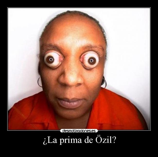 ¿La prima de Özil? -