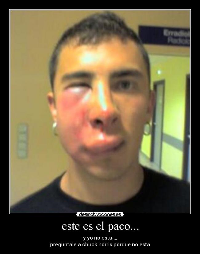 este es el paco... - 