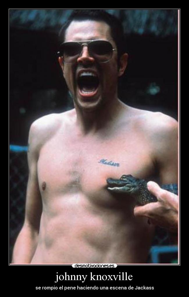 johnny knoxville - se rompio el pene haciendo una escena de Jackass