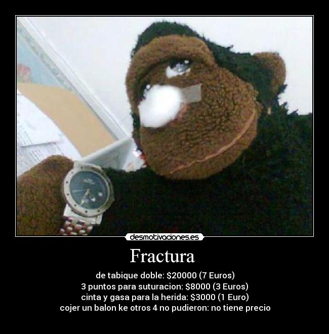 Fractura - de tabique doble: $20000 (7 Euros)
3 puntos para suturacion: $8000 (3 Euros)
cinta y gasa para la herida: $3000 (1 Euro)
cojer un balon ke otros 4 no pudieron: no tiene precio