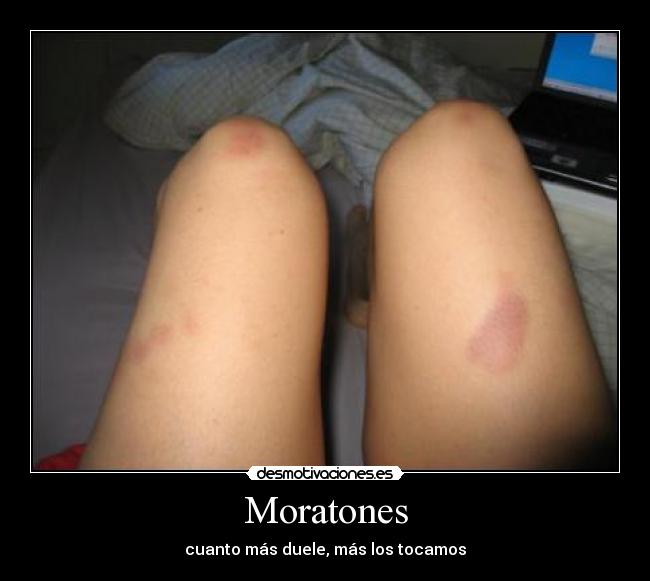 Moratones -