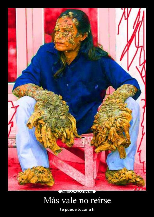 Más vale no reírse -