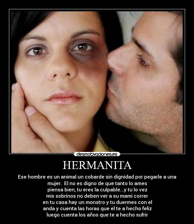 HERMANITA - Ese hombre es un animal un cobarde sin dignidad por pegarle a una
mujer. El no es digno de que tanto lo ames
piensa bien, tu eres la culpable...y tu lo vez
mis sobrinos no deben ver a su mami correr
en tu casa hay un monstro y tu duermes con el
anda y cuenta las horas que el te a hecho feliz
luego cuenta los años que te a hecho sufrir