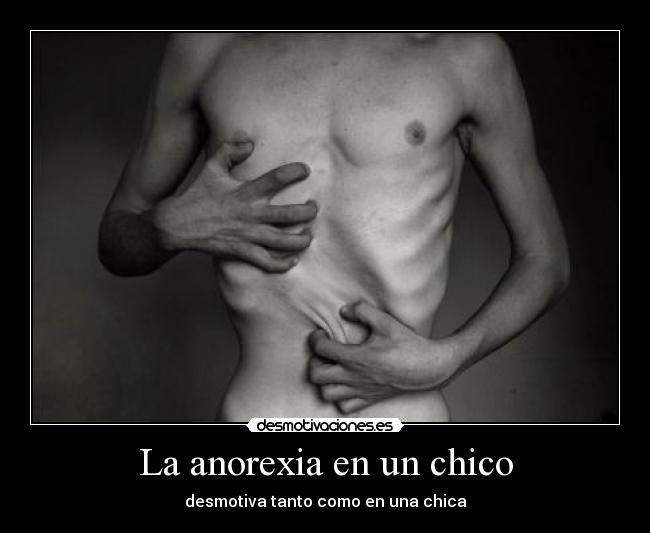 La anorexia en un chico - 