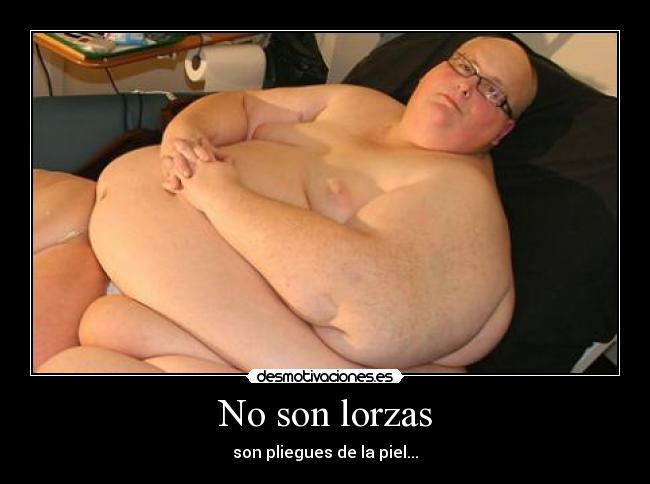 No son lorzas - son pliegues de la piel...