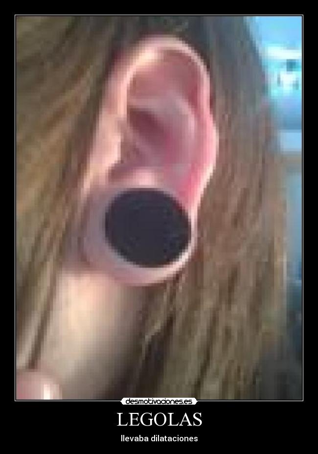 LEGOLAS - llevaba dilataciones