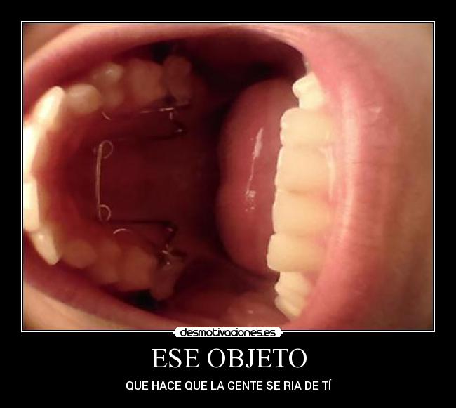 ESE OBJETO -