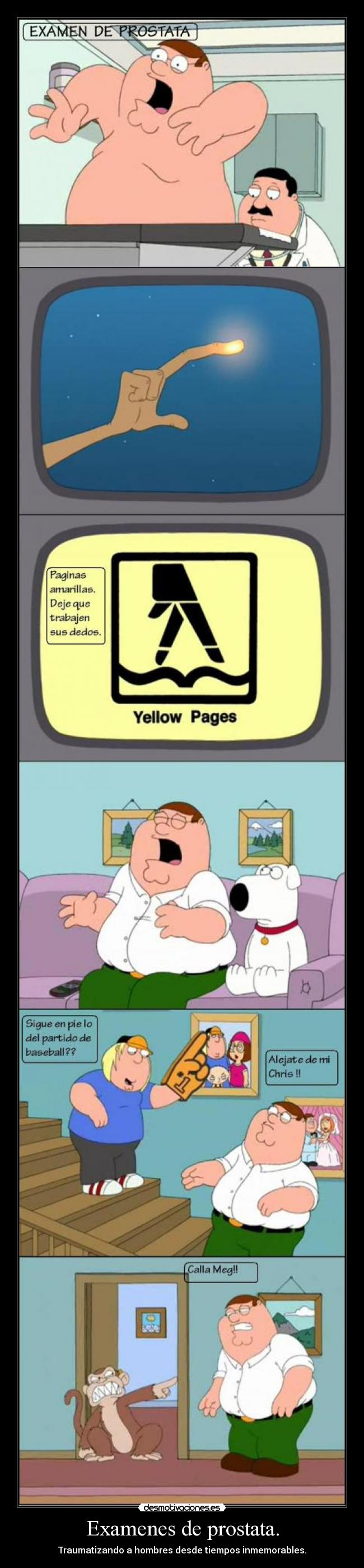 Examenes de prostata. -