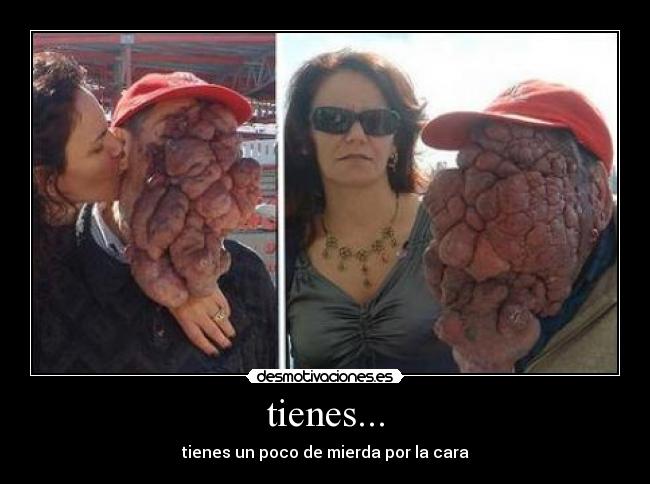 tienes... - 