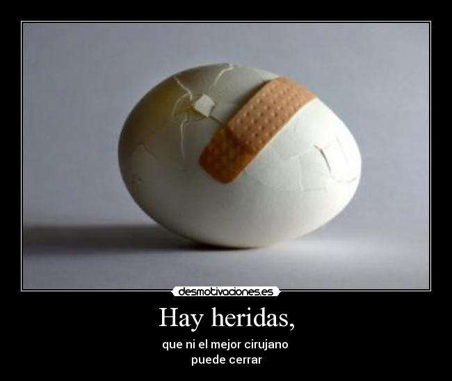 Hay heridas, -