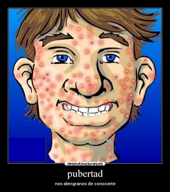 pubertad -
