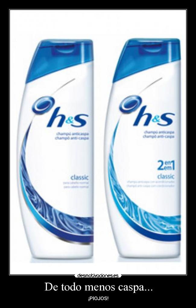 De todo menos caspa... -