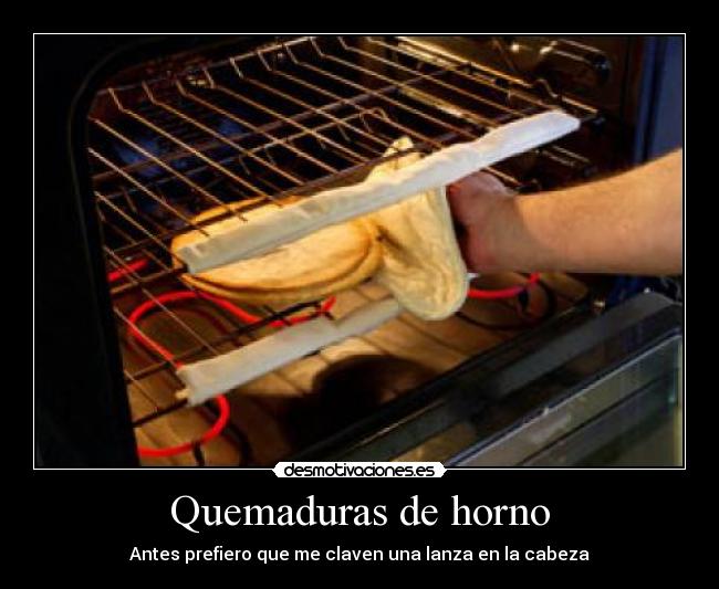 Quemaduras de horno - 