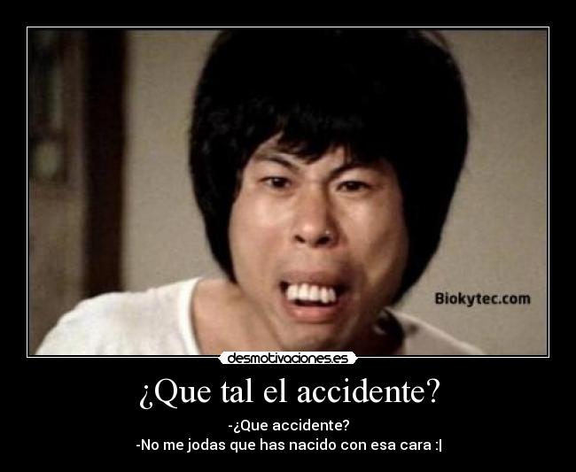 ¿Que tal el accidente? - -¿Que accidente?
-No me jodas que has nacido con esa cara :|